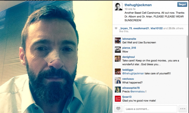 Hugh Jackman di nuovo operato per il tumore alla pelle
