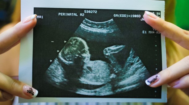 Giudice inglese ordina a una disabile di abortire (poi la sentenza viene ribaltata)