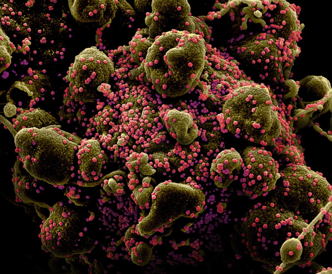 Perché col coronavirus si torna a sperare nel vecchio vaccino anti Tbc