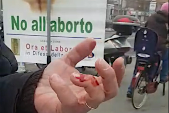 Qualcosa di poco bello sta succedendo alla società