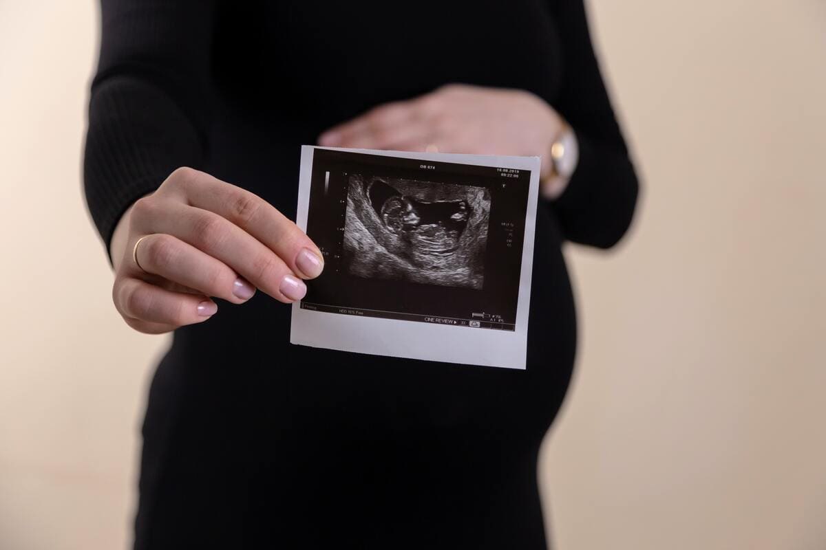 Aborto feto