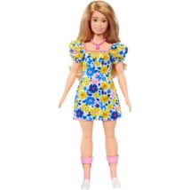Barbie sindrome di Down