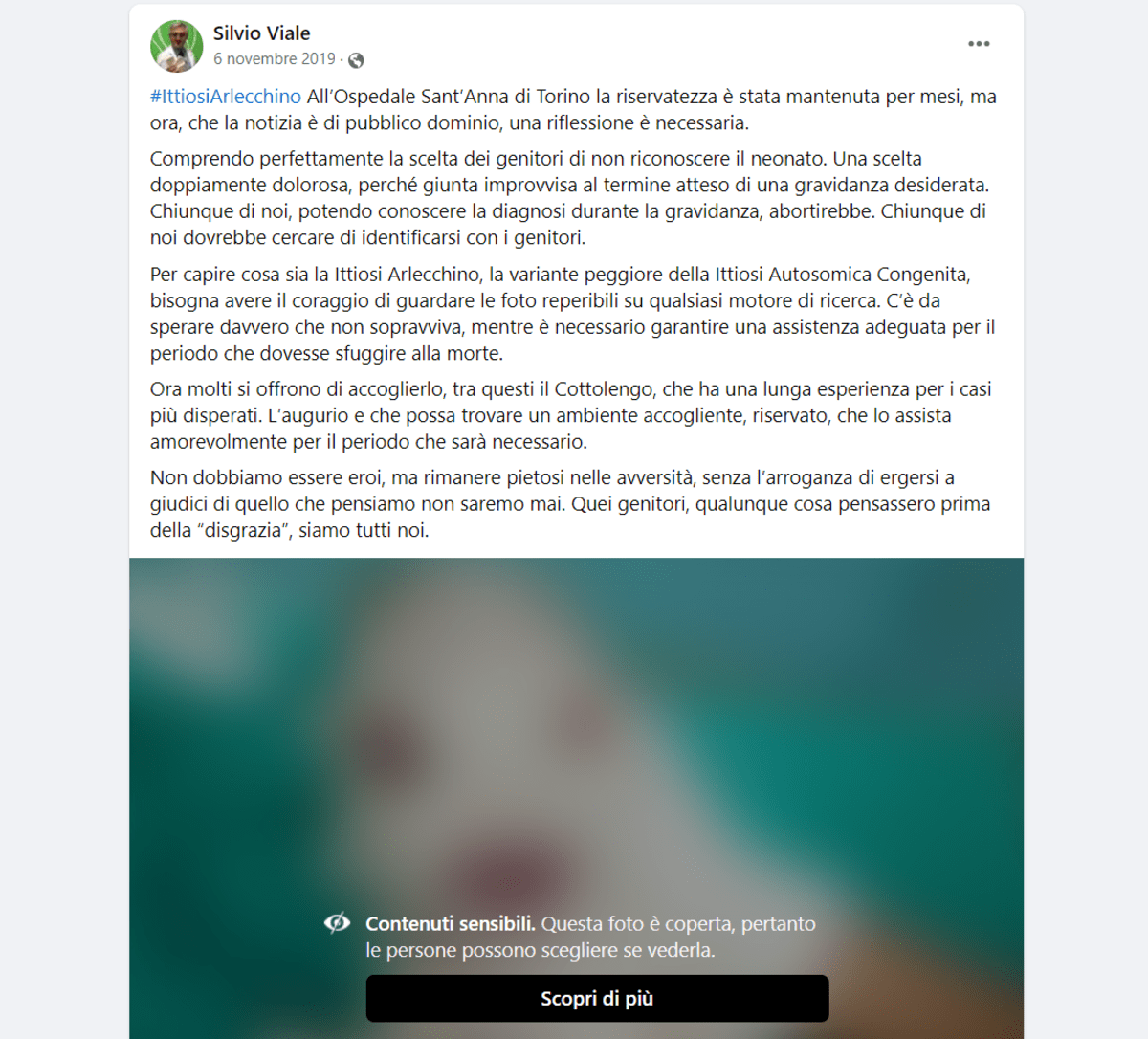 Silvio Viale è ginecologo dell’ospedale Sant’Anna di Torino, lo stesso ospedale dove si trovava Giovannino, il bimbo affetto da Ittiosi di Arlecchino, abbandonato dalla madre e dal padre dopo la nascita