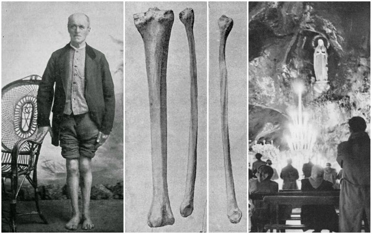 Miracoli Pietro De Rudder